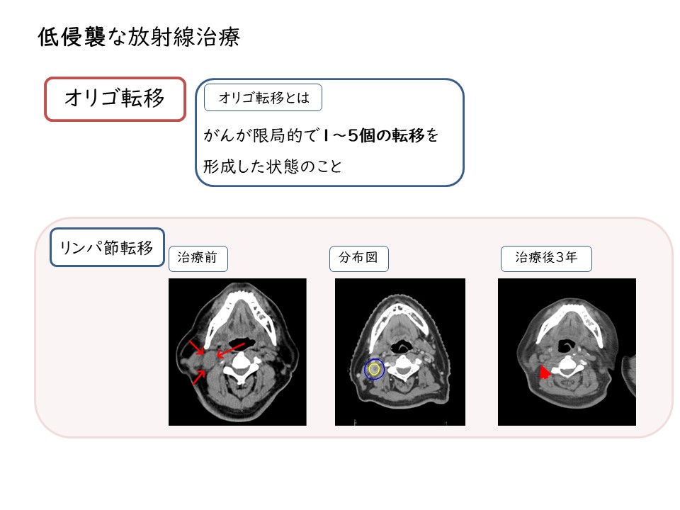 スライド5