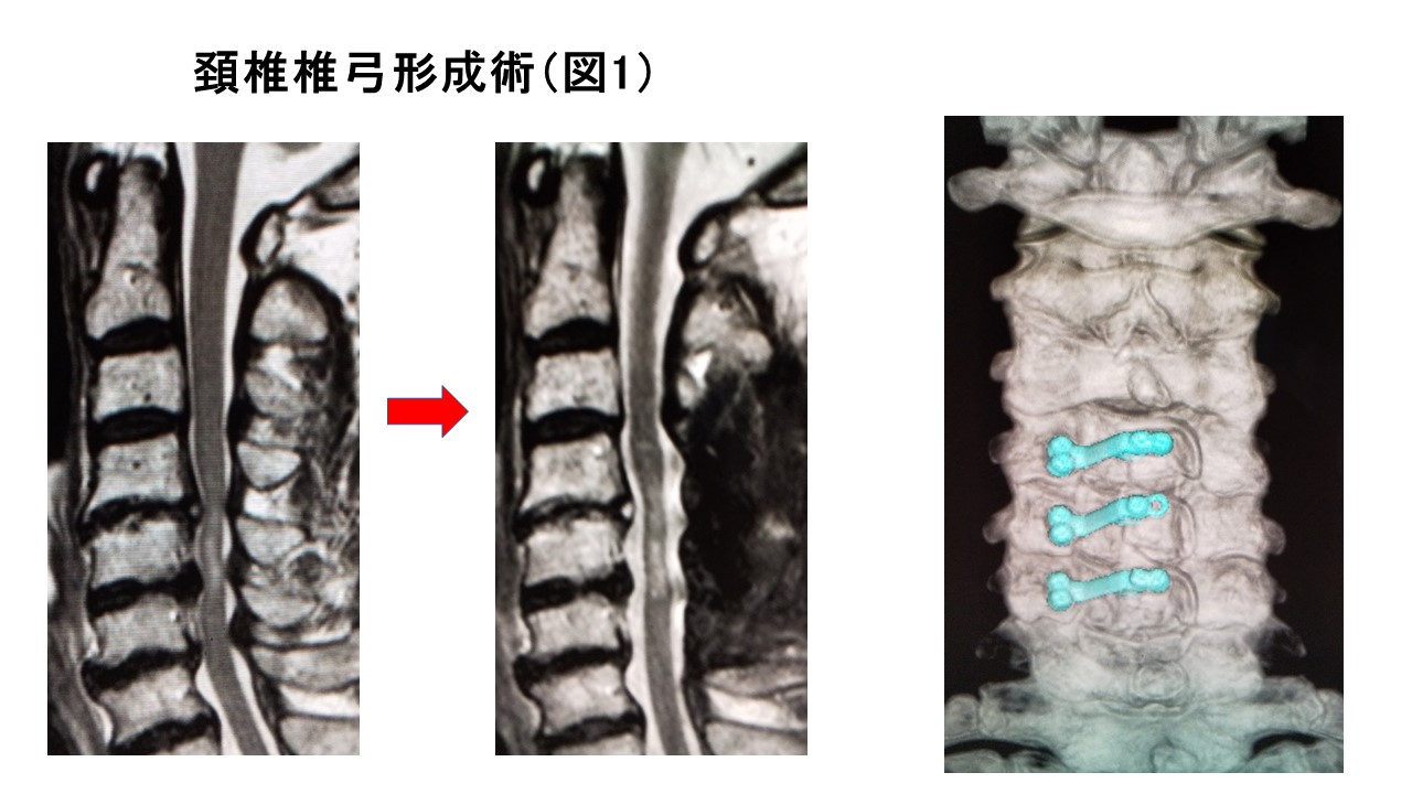 脊椎図1