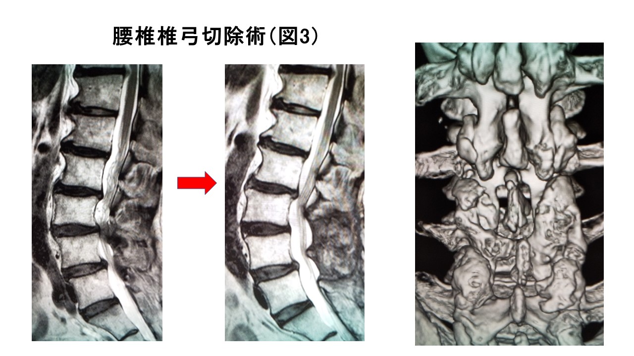 脊椎図3